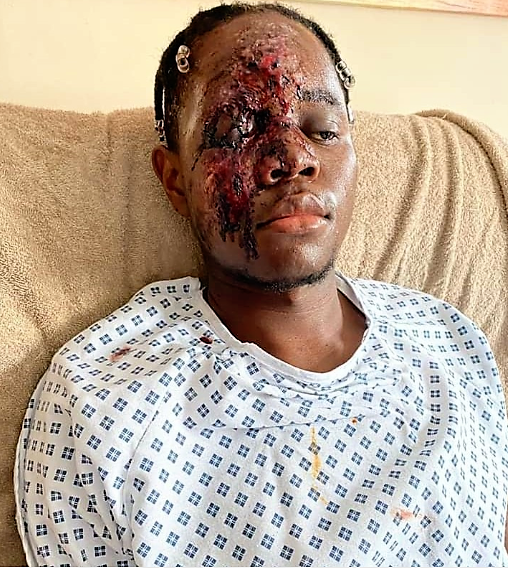 https://bluebloodz.com/index.php/2020/07/29/young-nhs-worker-badly-injured-after-racially-aggravated-hit-run-attack-graphic-photos/(opens in a new tab)
