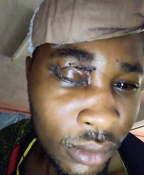 https://bluebloodz.com/index.php/2020/08/17/nigerian-man-give-thanks-to-god-after-surviving-a-close-shave-with-death/(opens in a new tab)