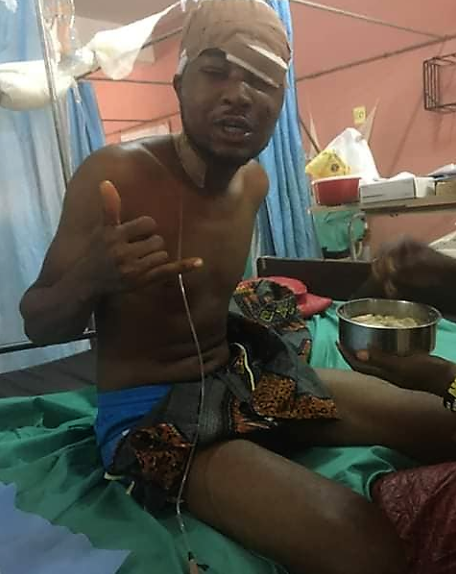 https://bluebloodz.com/index.php/2020/08/17/nigerian-man-give-thanks-to-god-after-surviving-a-close-shave-with-death/(opens in a new tab)