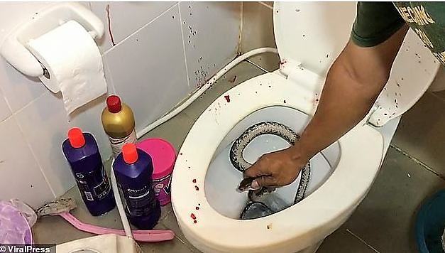 VIDEO : 18 year OLD BOY BITTEN ON HIS PENIS BY A PYTHON .